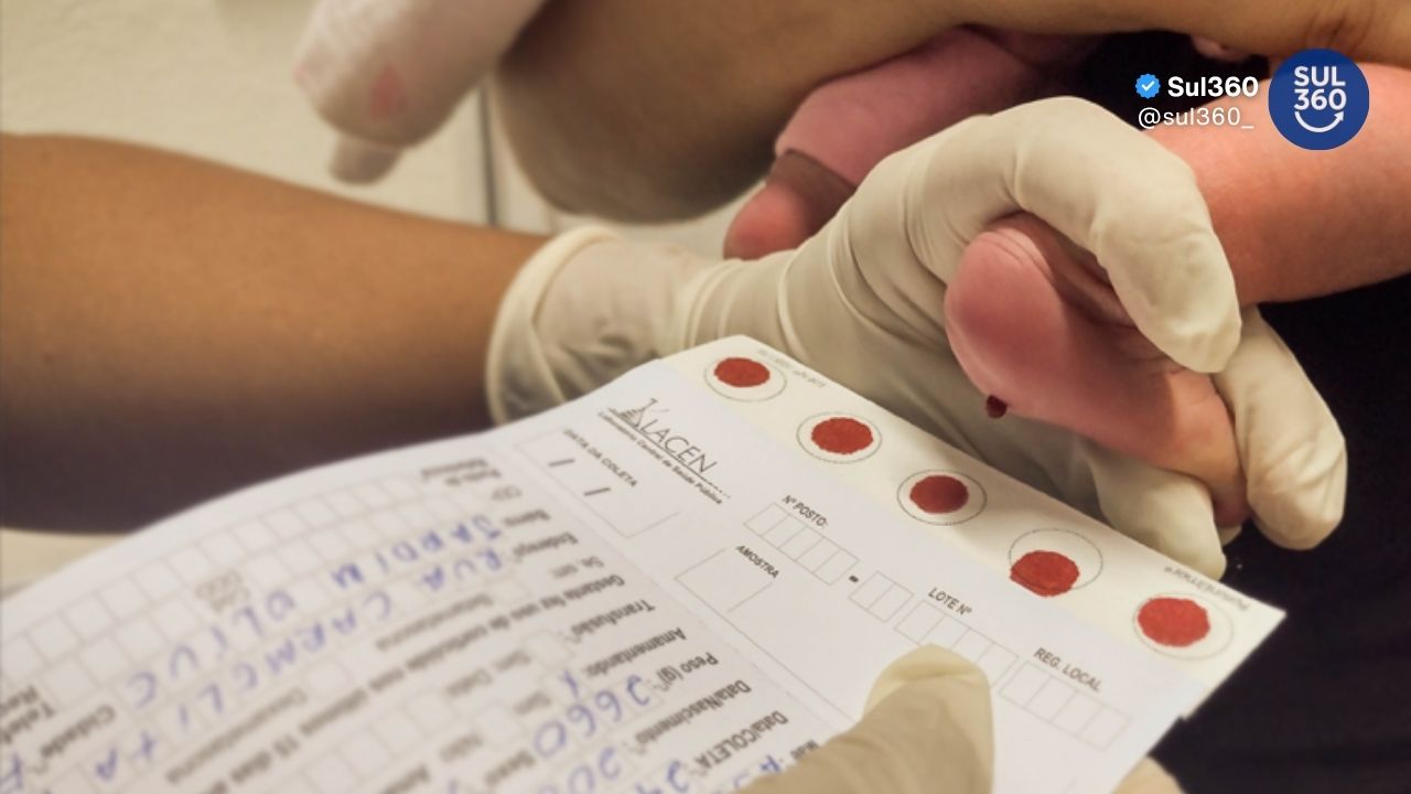 Teste do Pezinho completa 25 anos e reforça papel no diagnóstico precoce de doenças em recém-nascidos