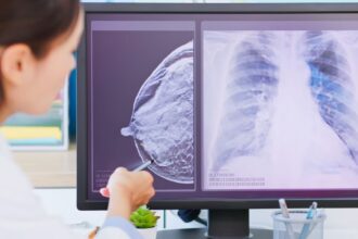 exame